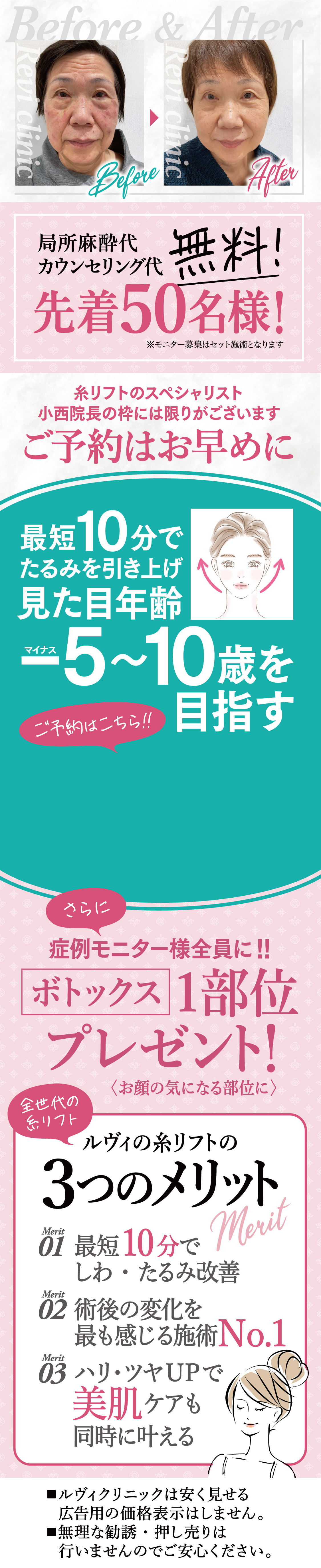 局部麻酔代・カウンセリング代、先着50名さま無料！
