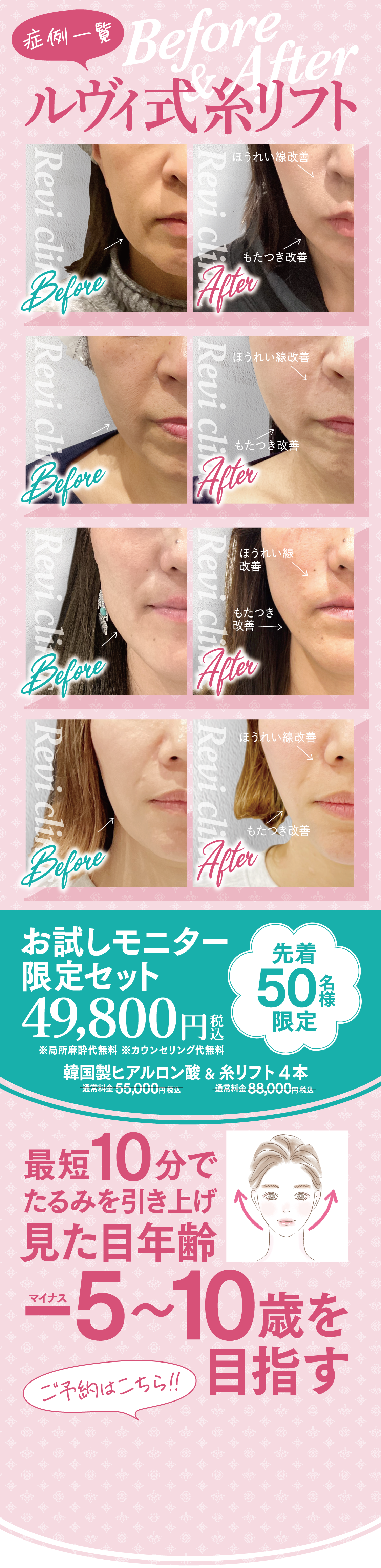 局部麻酔代・カウンセリング代、先着50名さま無料！